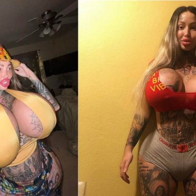 пластическая хирургия