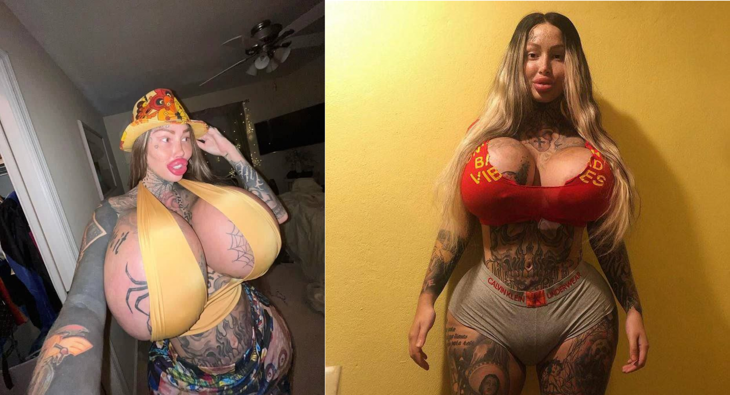 пластическая хирургия